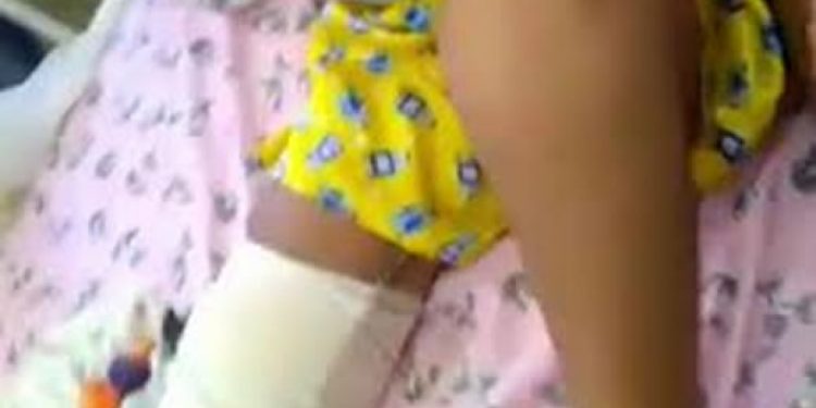 Hospital Público de Caririaçu usa papelão para imobilizar fratura exposta de criança