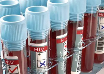 Em 11 anos, taxa de detecção de Aids no Ceará cresce 9,8%