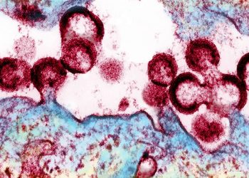 Cientistas descobrem ‘caminho’ para eliminar HIV totalmente do corpo