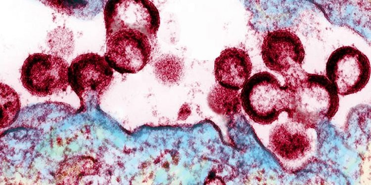 Cientistas descobrem ‘caminho’ para eliminar HIV totalmente do corpo