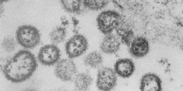 Cerca de 150 pessoas são monitoradas após caso de febre hemorrágica brasileira