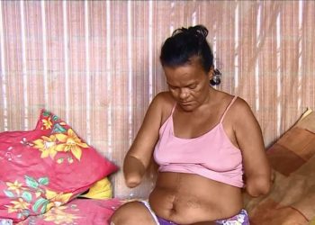 Cleomar diz que se sente constrangida após tantas negativas do INSS (Foto: Rede Amazônica/Reprodução)