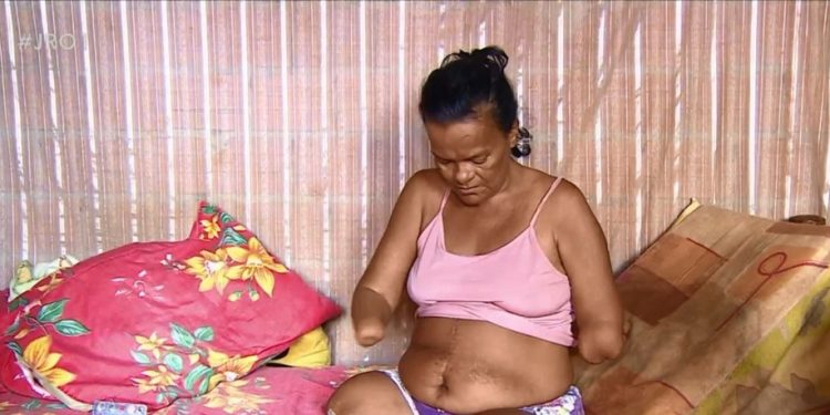 Mulher sem mãos e pernas tem pedido de benefício negado pelo INSS por não poder assinar papel