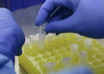 Diagnóstico laboratorial do coronavírus realizado pelo Laboratório de Vírus Respiratório e Sarmpo do Instituto Oswaldo Cruz (Foto: José Damacena/IOC Fiocruz)