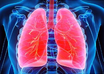 Consumo de álcool em excesso aumenta risco de câncer de pulmão, diz estudo