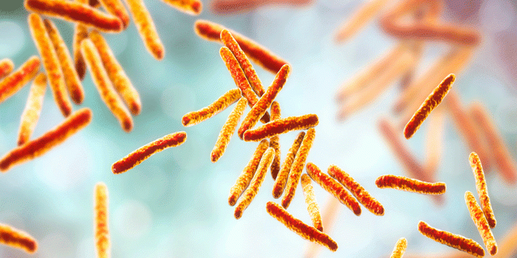 Ceará ultrapassa 20 mil casos de tuberculose nos últimos seis anos