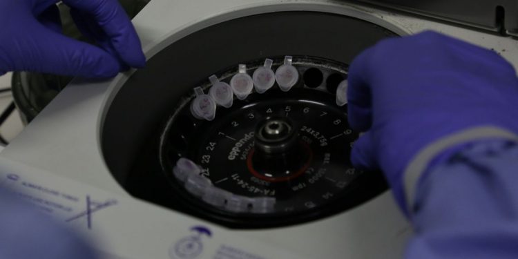 Brasil tem apenas um caso suspeito do coronavírus