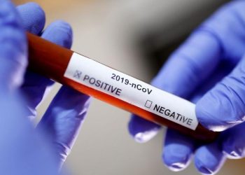 Vacina contra coronavírus estará pronta para teste em 3 meses, diz infectologista