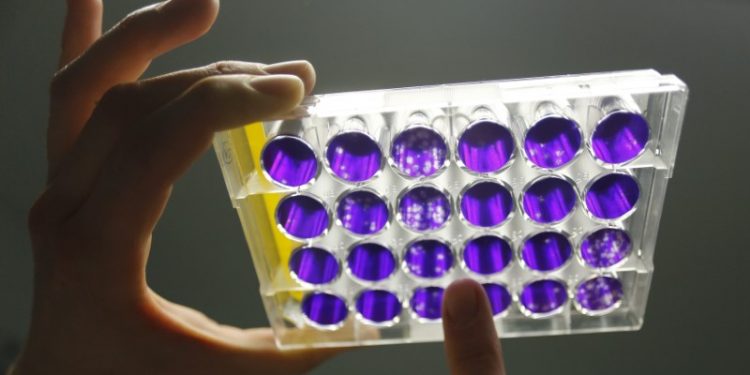 Cientistas da UFBA descobrem teste que detecta coronavírus em 3h