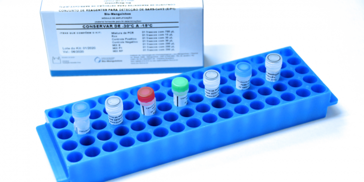 Com 19 casos suspeitos, Ceará receberá kits para detecção de coronavírus