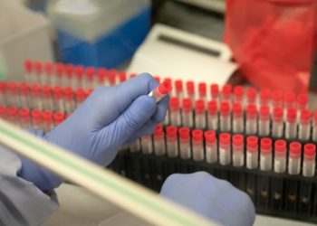 Coronavírus: Sete países europeus iniciam testes de remédios com 3.200 pacientes