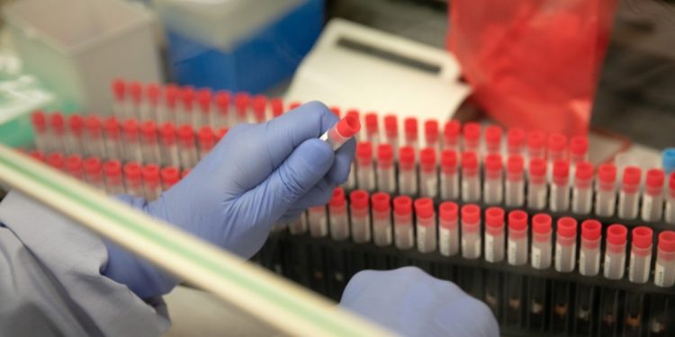 Coronavírus: Sete países europeus iniciam testes de remédios com 3.200 pacientes