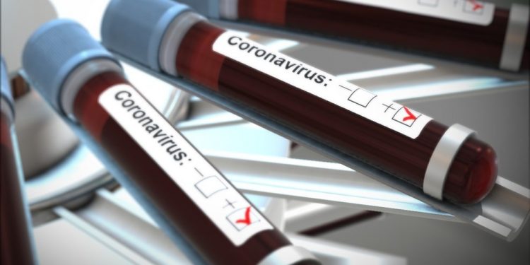 Casos de coronavírus chegam a 282 em 13 dias no Ceará; não há registro de mais mortes