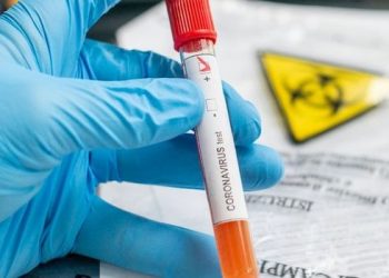 Confirmadas três mortes por coronavírus no Ceará