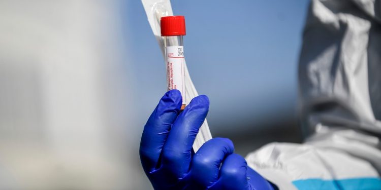 Coronavírus pode sobreviver em papelão e plástico por até 72h, diz estudo