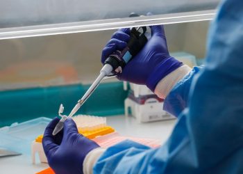 Número de testes para o novo coronavírus no Ceará pode triplicar em até dois meses