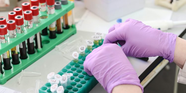 Coronavírus: Ceará lidera ranking de transparência sobre pandemia no Brasil