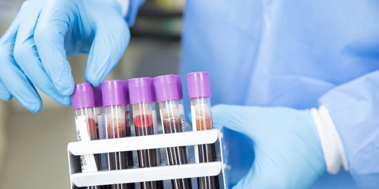 Coronavírus: Das três cidades que fazem parte da RMC, Barbalha receberá a maior parte dos recursos