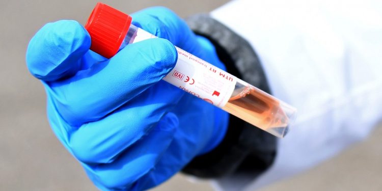 Crato tem novos casos de coronavírus; números no Ceará e no Brasil crescem