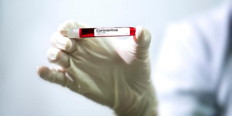 Laboratório americano anuncia resultados positivos em teste com medicamento para coronavírus