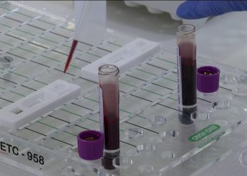 Número de casos de covid-19 sobe para 7.910; mortes chegam a 299