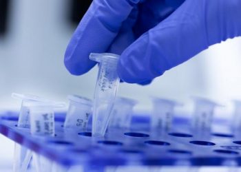 Mortes por coronavírus no CE mais que dobraram em 24h considerando dados do Ministério da Saúde