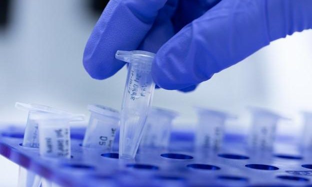 Mortes por coronavírus no CE mais que dobraram em 24h considerando dados do Ministério da Saúde