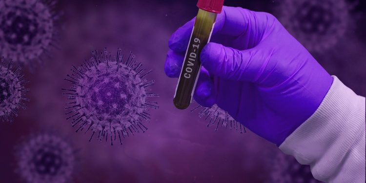 Um em cada quatro mortos por Covid-19 no Ceará tem menos de 60 anos