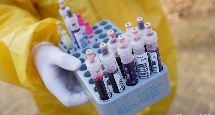 SP, RJ, DF, CE e AM podem entrar em fase de aceleração descontrolada do coronavírus, diz ministério