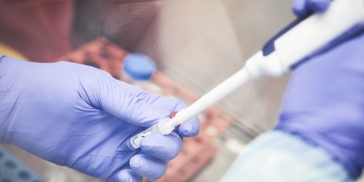 Covid-19: mortes superam 2,9 mil; recuperados são 25,3 mil