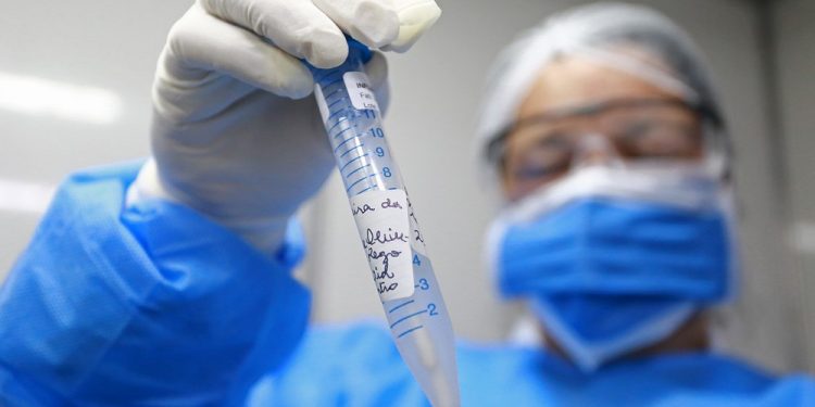 Ceará tem 6,7 mil casos de Covid-19; total de mortes chega a 397