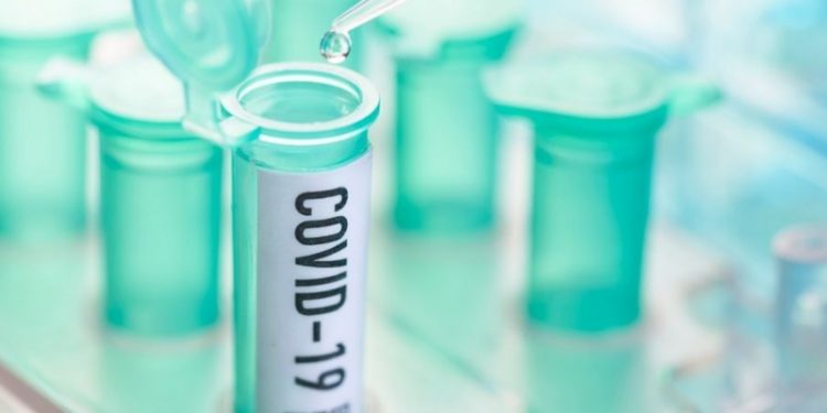 Coronavírus: Brasil tem 449 mortes confirmadas em 24 h; total chega a 5.466