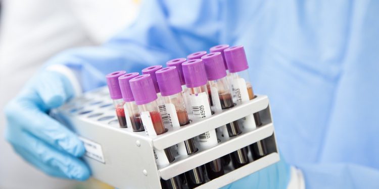 Covid-19: Estudo indica que primeiros sintomas são diferentes em crianças