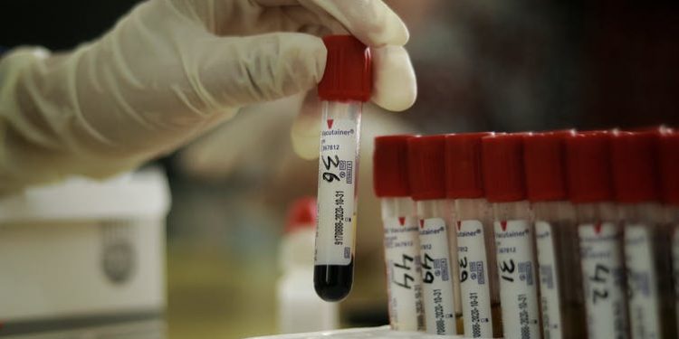 Com novo recorde, Ceará tem 261 mortes por Covid-19 confirmadas nas últimas 24 horas