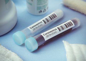 Detail of coronavirus test tubes
