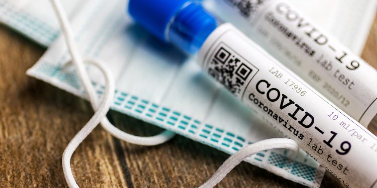 Covid-19: Ceará alcança pontuação máxima em ranking de transparência