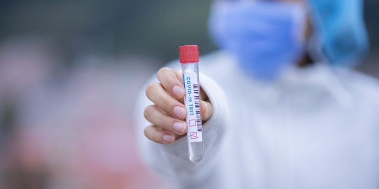 Ceará chega a 35.122 casos confirmados de Covid-19 e 2.308 mortes