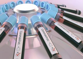 (Foto: Getty Images)