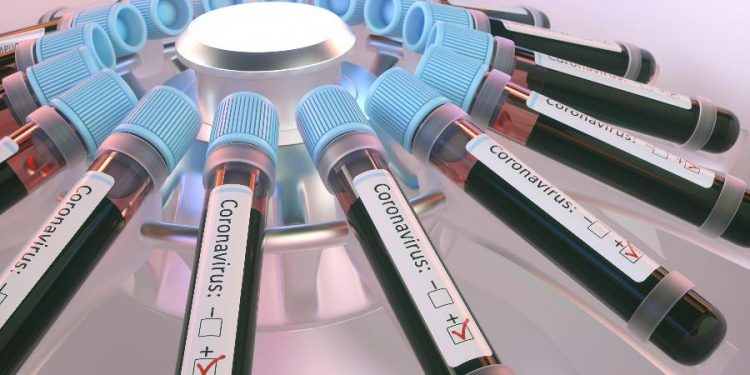 Brasil supera 363 mil casos de coronavirus e 22,6 mil óbitos