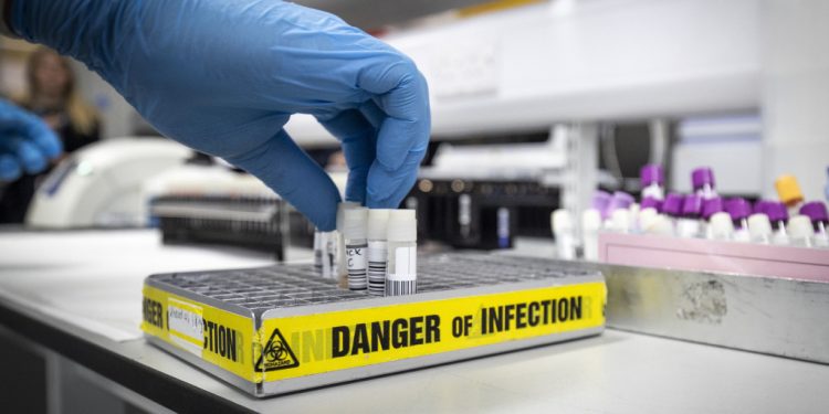 Brasil registra 14,9 mil novos casos e 816 novas mortes por Covid-19