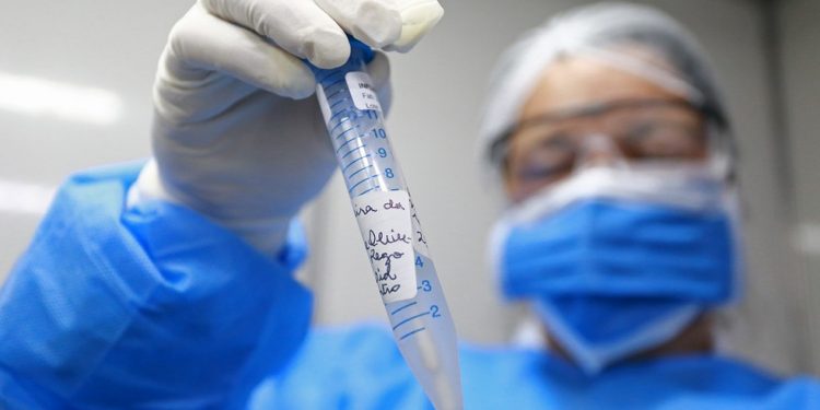 Coronavírus já circulava no Ceará em janeiro sem ser detectado, confirma Secretaria da Saúde