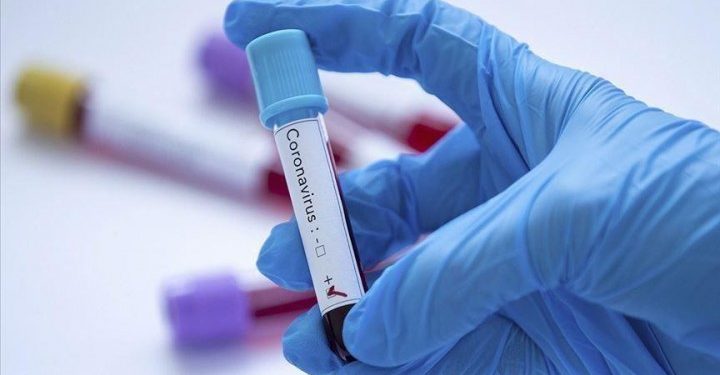 Ceará ultrapassa 30 mil casos de Covid-19; mortes somam 1.900