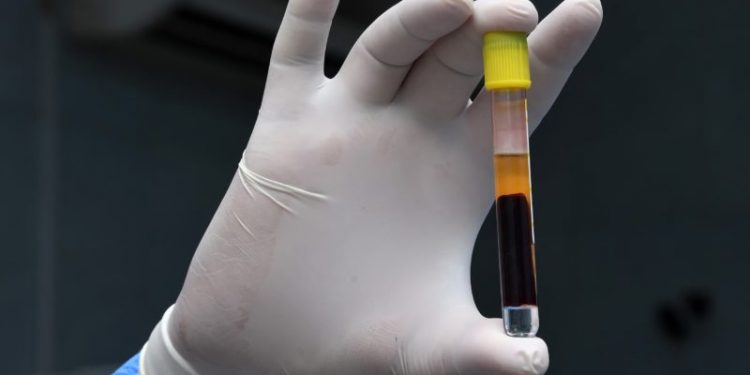 Quanto tempo dura a imunidade ao coronavírus? A resposta pode ir além dos anticorpos