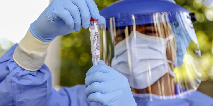 Ceará atinge menor taxa de transmissão da Covid-19, mas isolamento social é fundamental para frear avanço do vírus