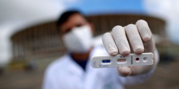 Brasil registra 1.280 óbitos por Covid-19 nas últimas 24 horas