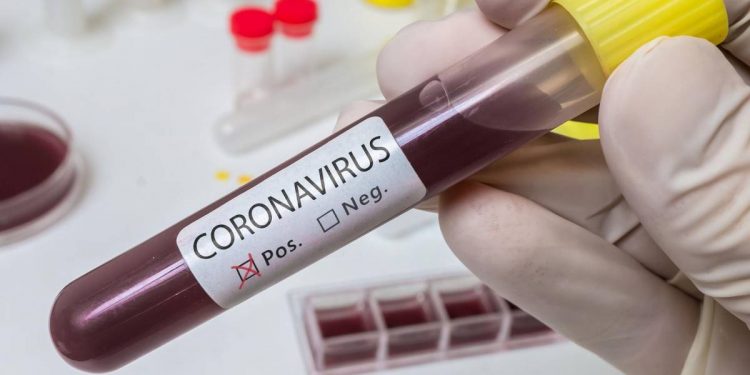 Juazeiro do Norte registra alta nas infecções por Covid-19 ao ampliar testes