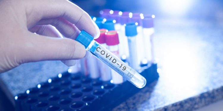 Covid-19: Brasil chega a 526,4 mil casos e 29,9 mil mortes