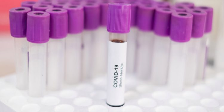 Após críticas, Ministério da Saúde disponibiliza nova plataforma para acompanhamento da Covid-19