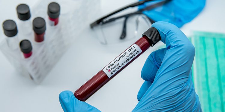 Ceará registra 56.056 casos de Covid-19; mortes superam 3,6 mil