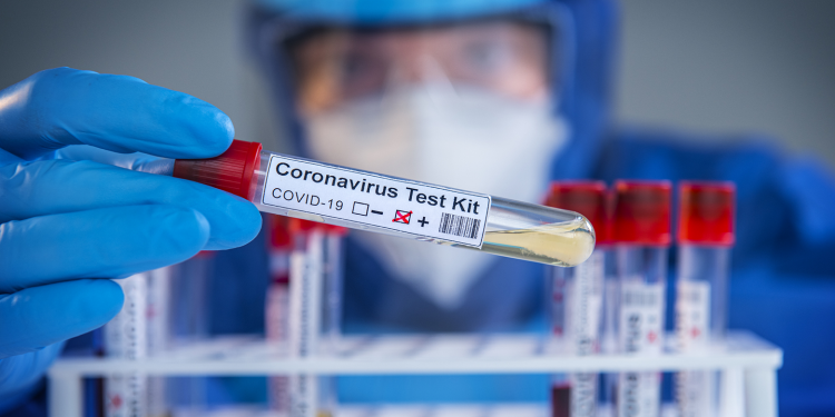 Ceará confirma 99.578 casos da Covid-19 e 5.815 óbitos